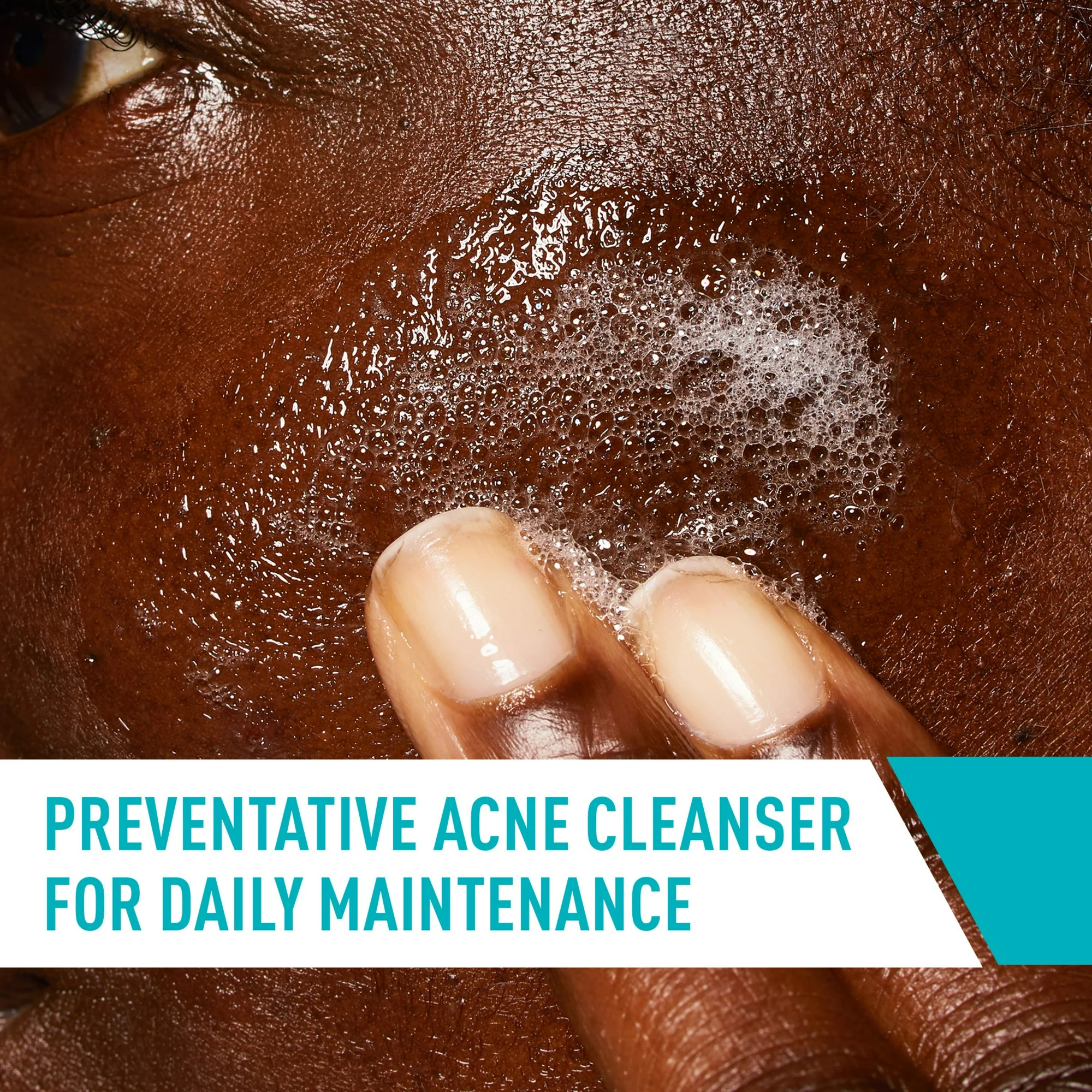 CeraVe Acne Control Face Cleanser, 473ml - Image 5