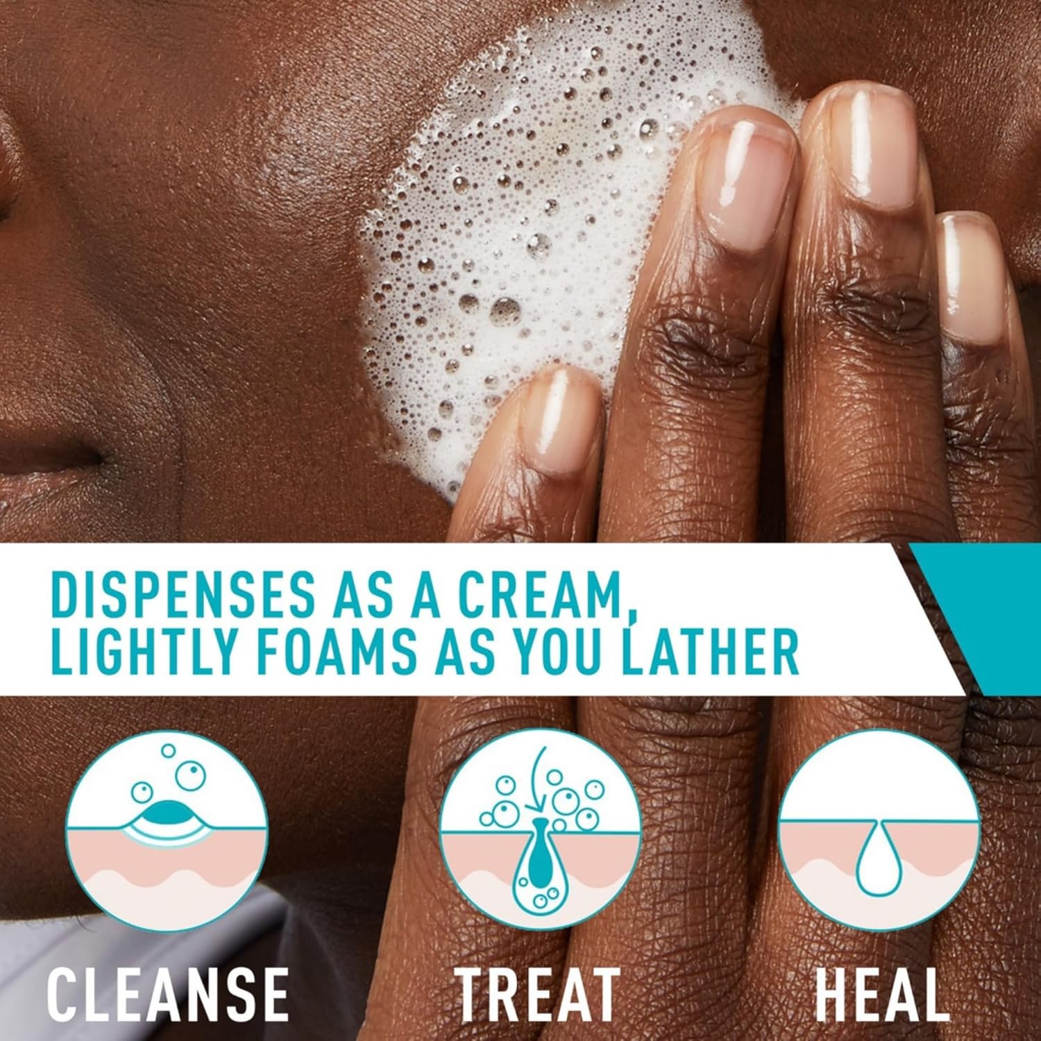 CeraVe Acne Foaming Cream Cleanser, 150ml - Image 3