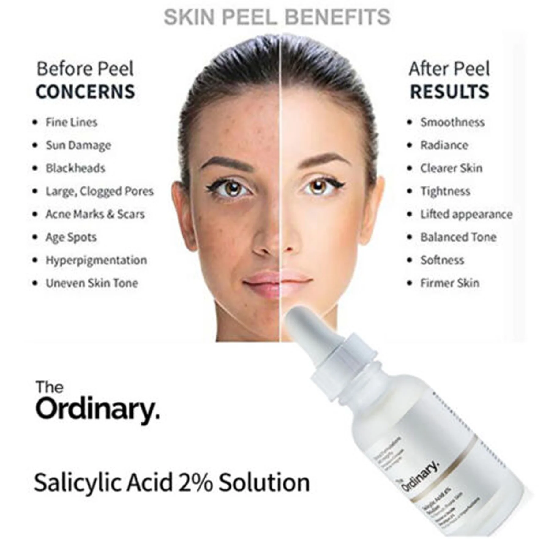 The Ordinary Salicylic Acid 2% Solution, 30ml - Image 2