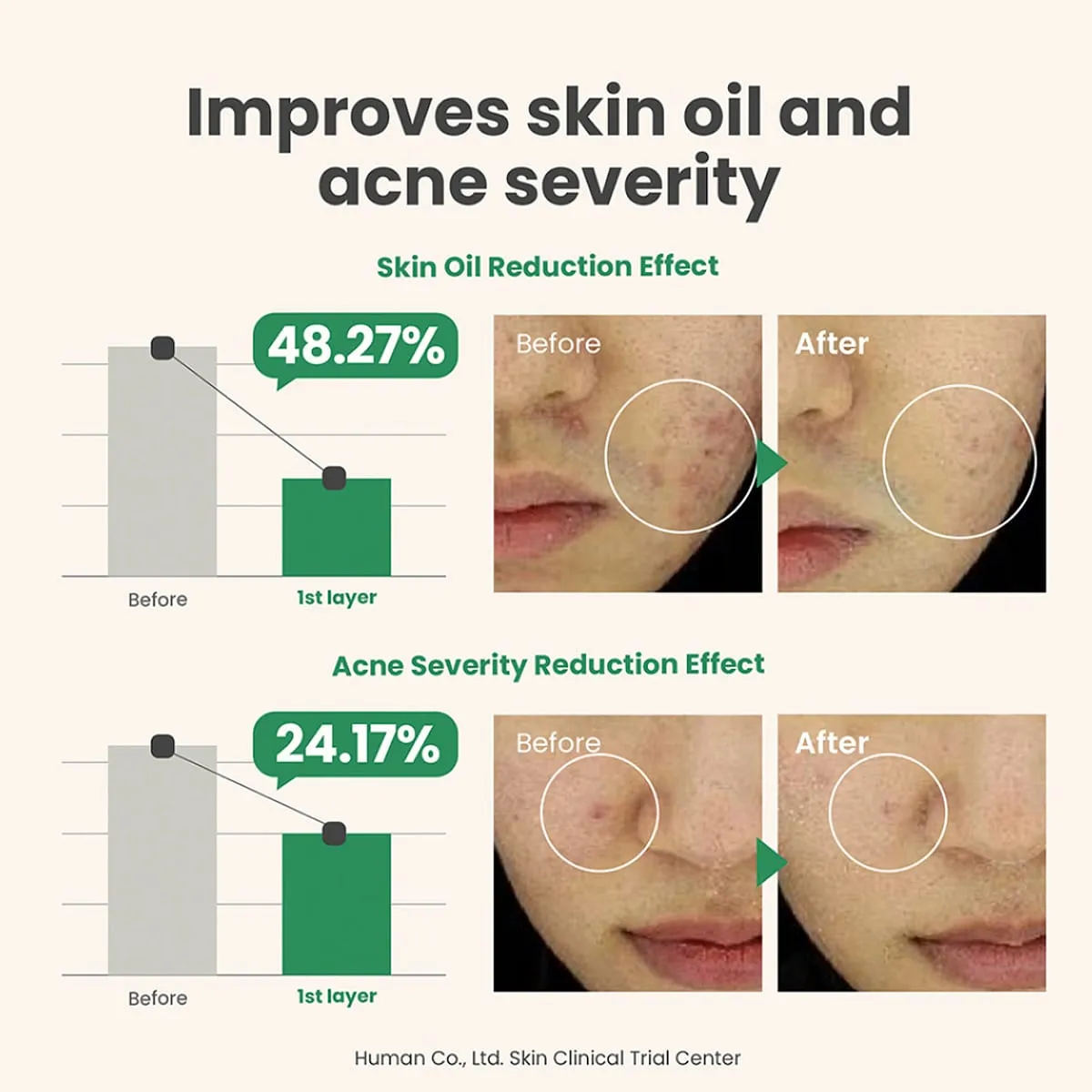 Axis-Y Spot The Difference Blemish Treatment 15ml - Image 4