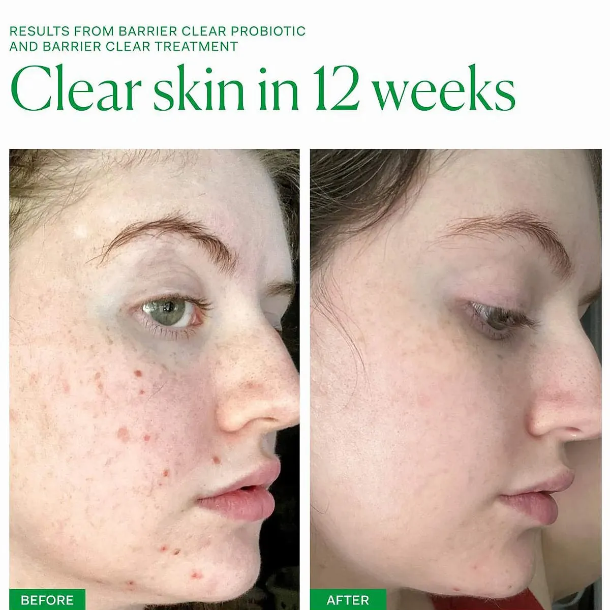Axis-Y Spot The Difference Blemish Treatment 15ml - Image 3